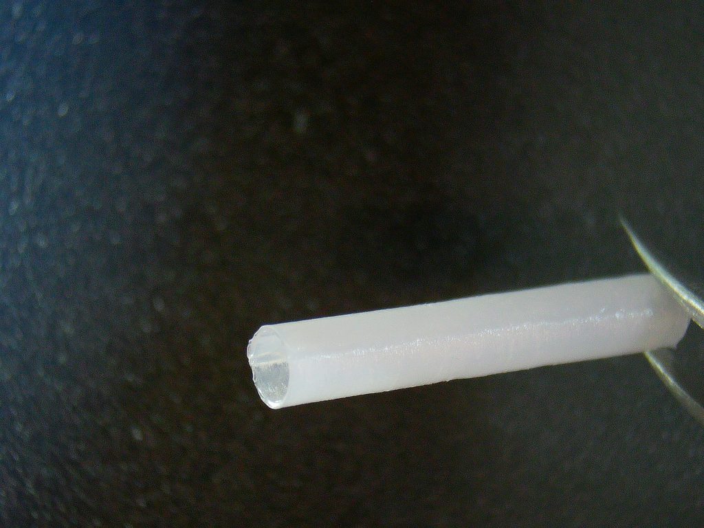 Business Case - Pioneer Neurotech - PDO Business Case – Pioneer Neurotech – PDO